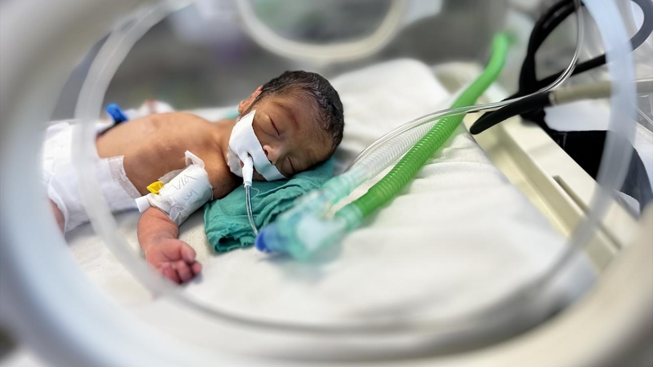 gazze-premature-bebek-a-2372948.jpg