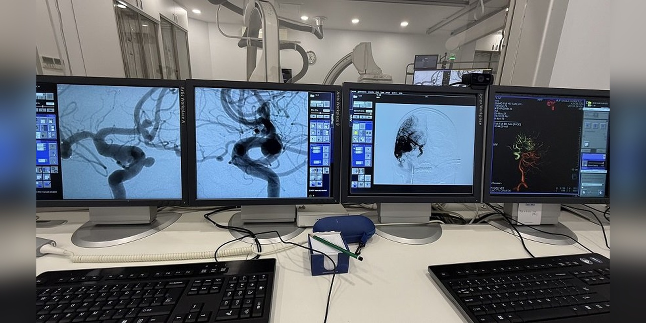 Türk NöroRadyologlar, Çin'de 3 Bin Doktor'a Beyin Damar Hastalıkları Tedavisini Öğretecek