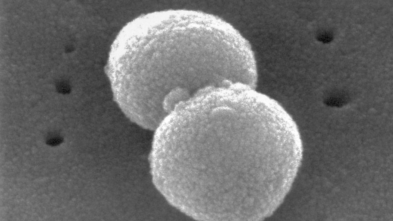 super-antibiyotik-2364735.jpg