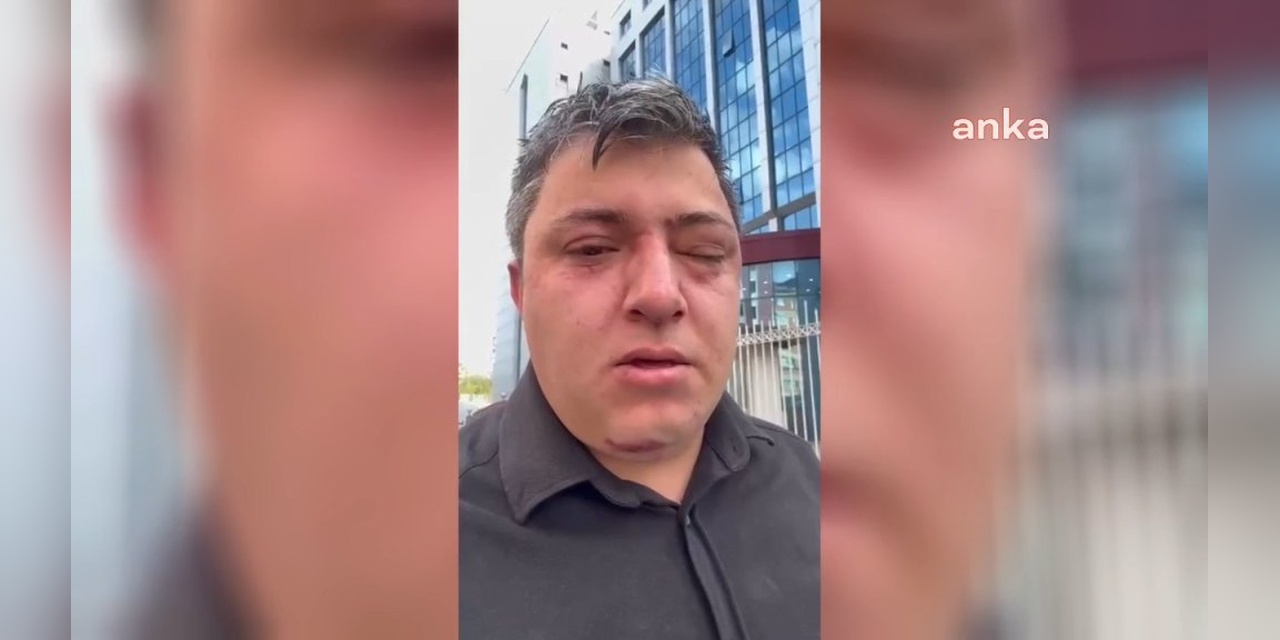 Altındağ Belediyesi'nde darp iddiası: Zabıta Müdürü tutuklandı